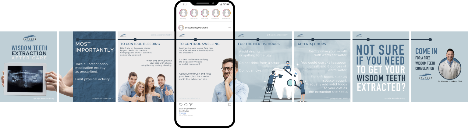 instagram content carrousel design for dental office